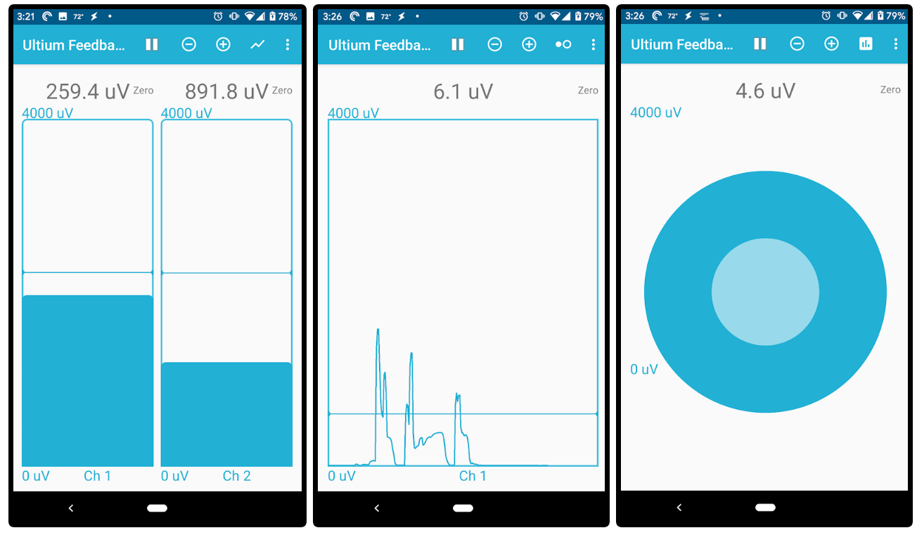 Noraxon-emg-oprogramowanie-biofeedback