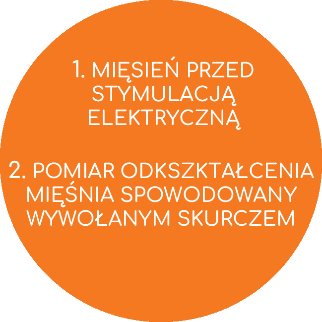 TMG-Opis-procedura-działanie