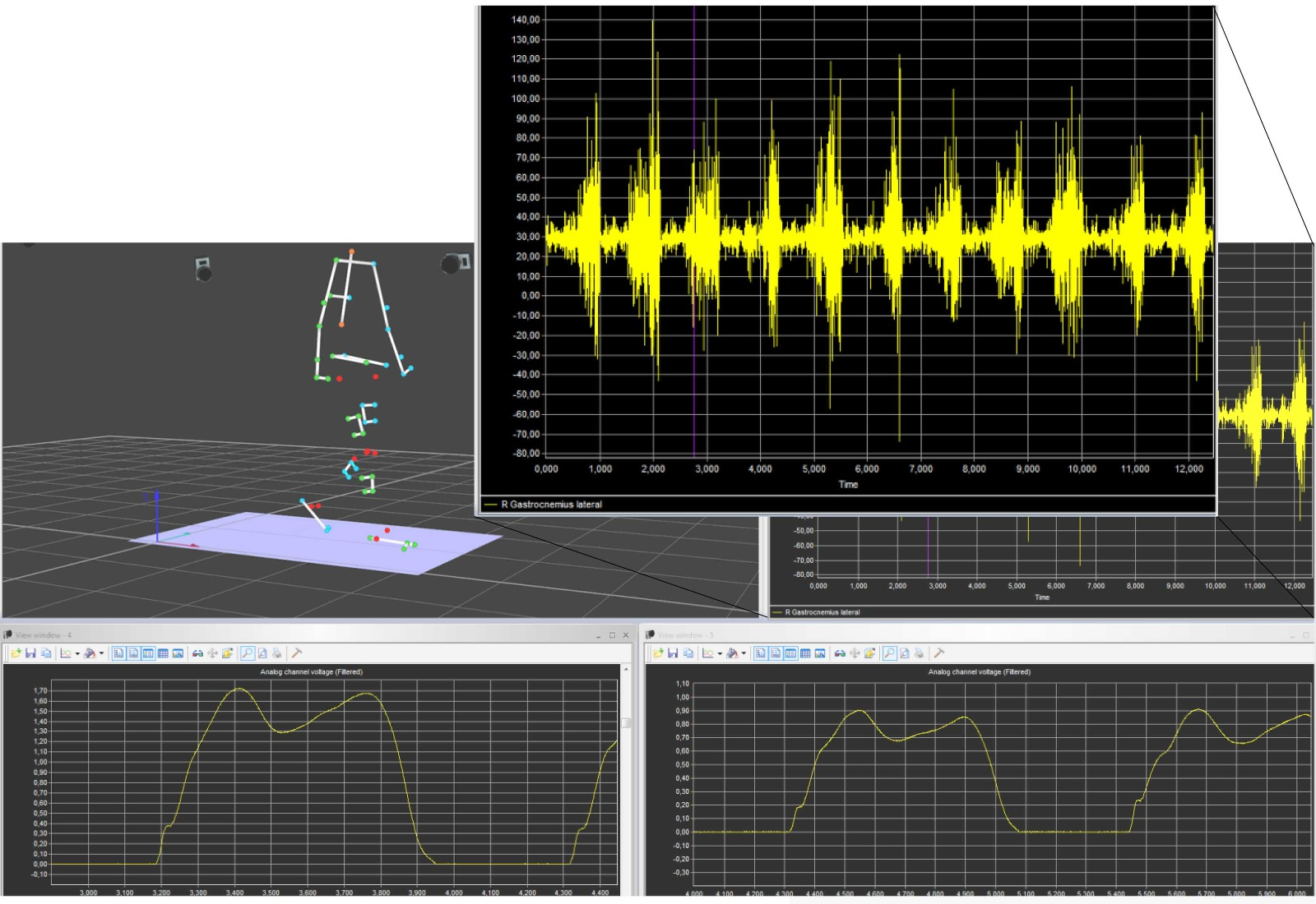 EMG-analiza-diagnostyka-Qualisys-Skyfi